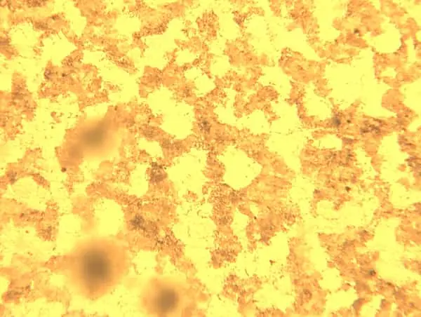 Microstructure of Pearlite and martensitic transformation